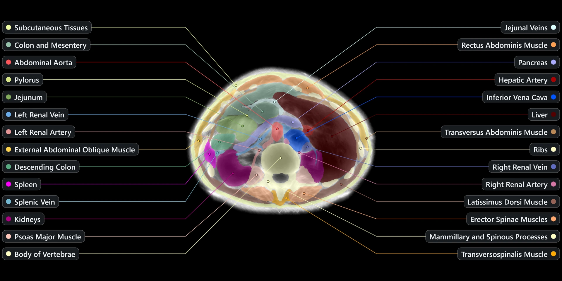 Labeled Midjourney Medical upper abdomen ultrasound CT segmentation with organs and tissue regions highlighted.