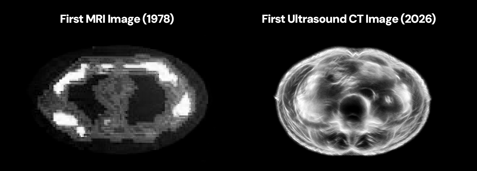 Midjourney Medical comparison showing a first MRI image from 1978 beside a first ultrasound CT image from 2026.