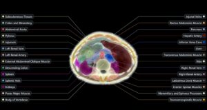 Official Midjourney Medical upper abdomen ultrasound CT segmentation with labeled organs and tissue regions.