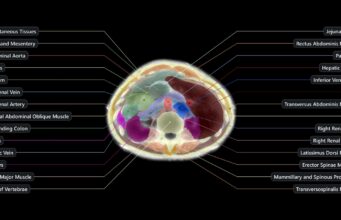 Midjourney Medical Shows The Claims Behind Its 60-Second Body Scanner Official Midjourney Medical upper abdomen ultrasound CT segmentation with labeled organs and tissue regions.