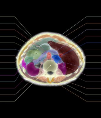 Midjourney Medical Shows The Claims Behind Its 60-Second Body Scanner Official Midjourney Medical upper abdomen ultrasound CT segmentation with labeled organs and tissue regions.