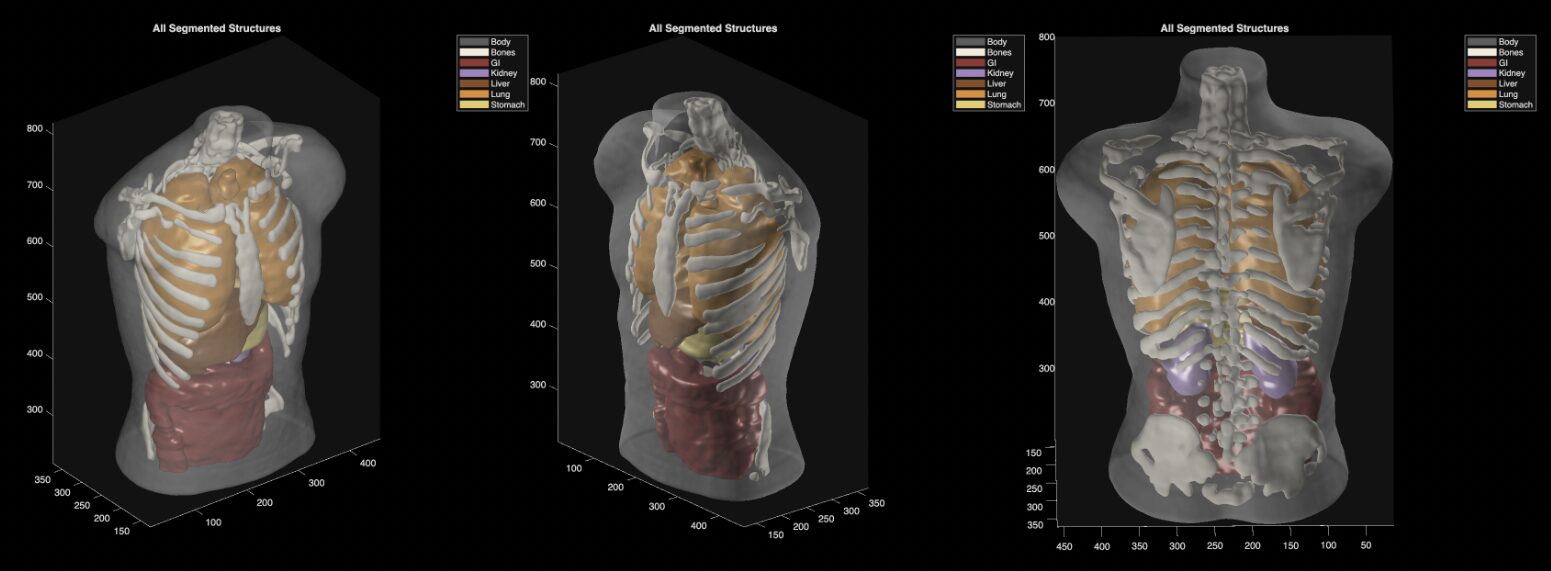 Three views of a segmented ultrasound imaging phantom from Midjourney Medical.