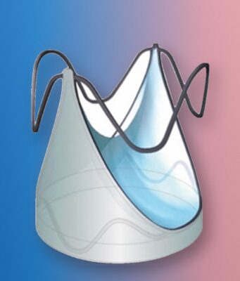 AUTUS Valve Wins FDA Approval for Children AUTUS valve expanded-state device render on a colorful editorial background