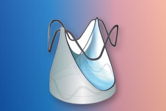 AUTUS valve expanded-state device render on a colorful editorial background